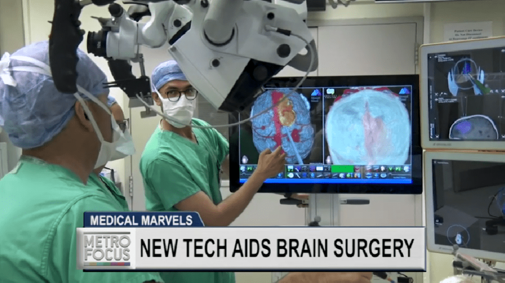 metrofocus new tech aids in brain surgery