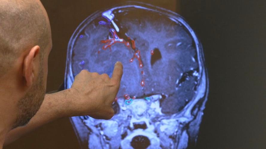 Virtual reality helping Louisville doctors perform safer surgeries