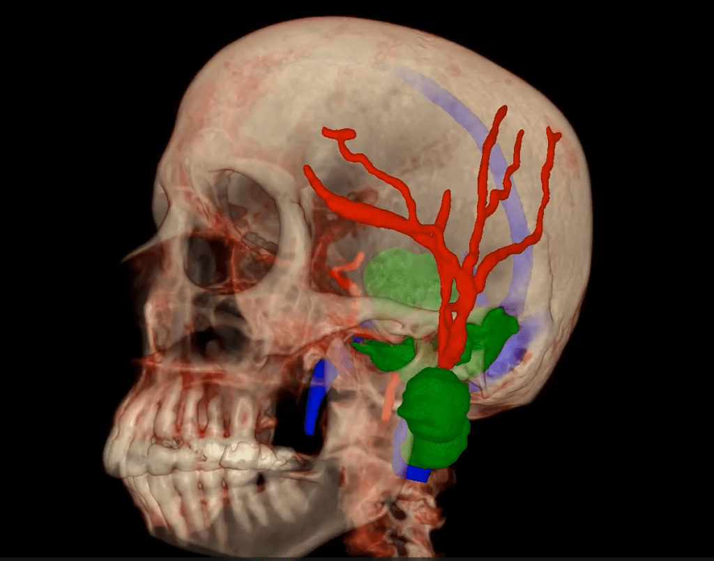 Why Settle for 2 Surgery Image