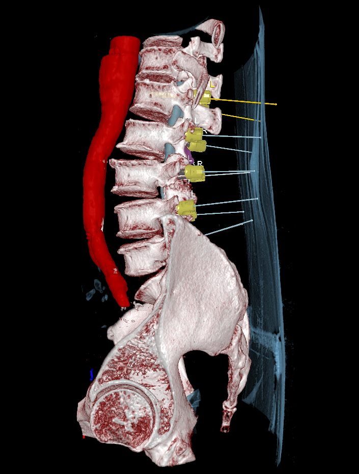 Blog Image Sag