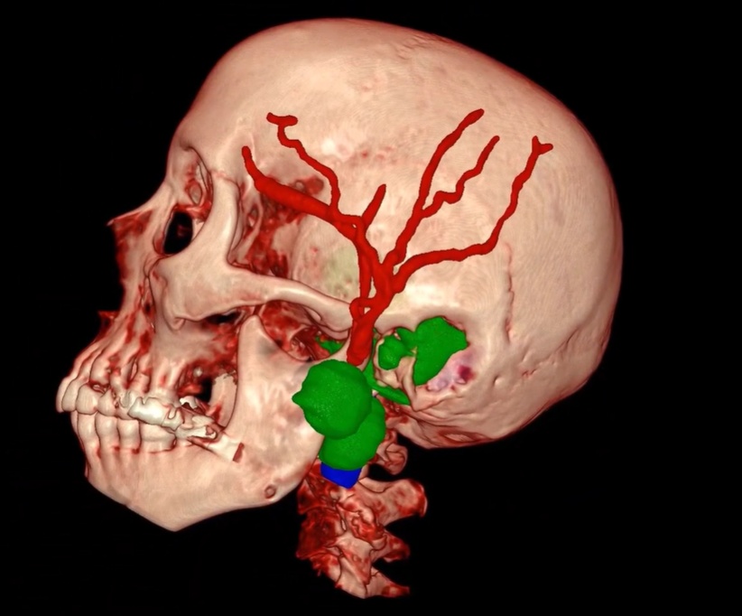 3D image